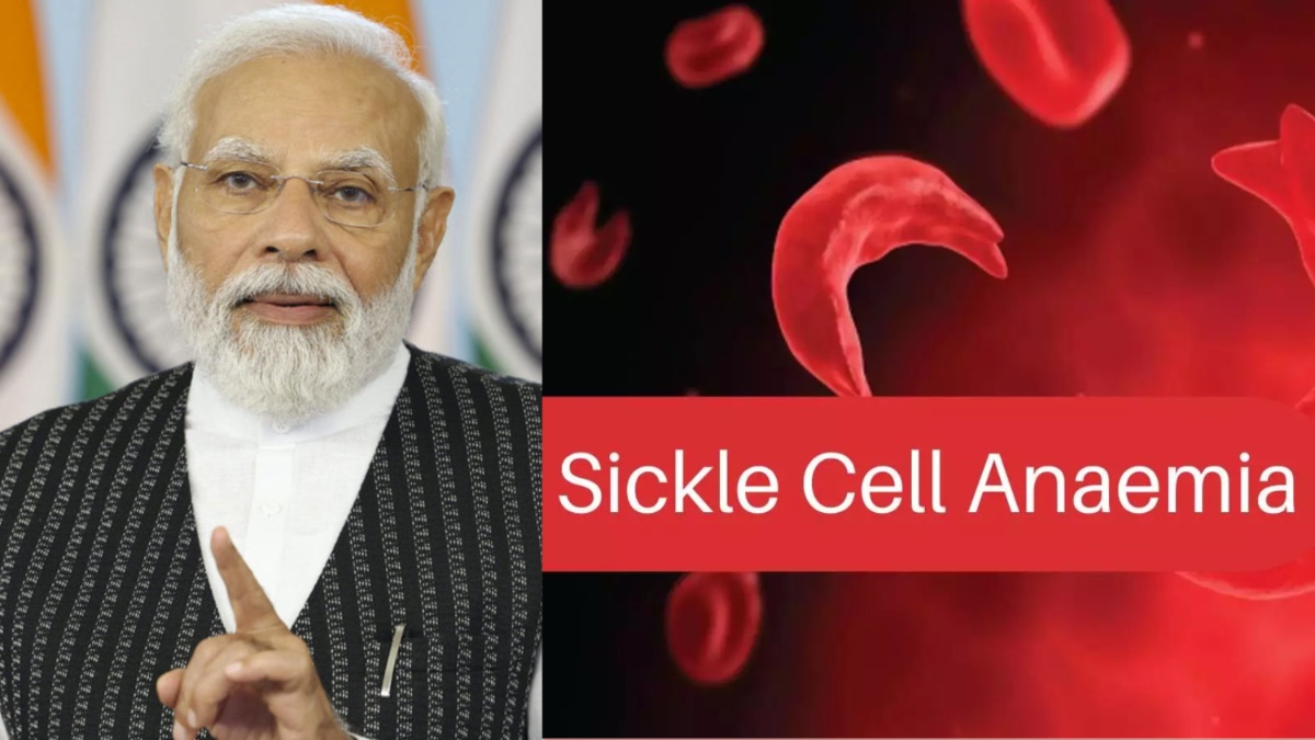 Sickle Cell Anaemia Elimination