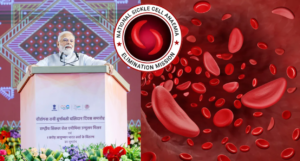 Sickle Cell Anaemia Elimination 